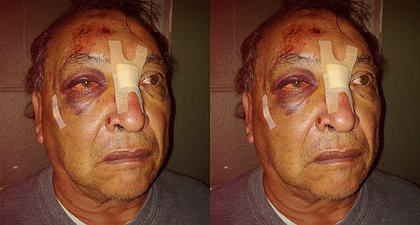 GoFundMe Set Up For 64-year-old Paletero Who Was Beaten Unconscious And Robbed